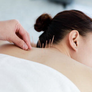 Acupuncture for Women’s Health
