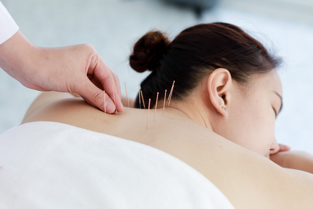 Acupuncture for Women’s Health
